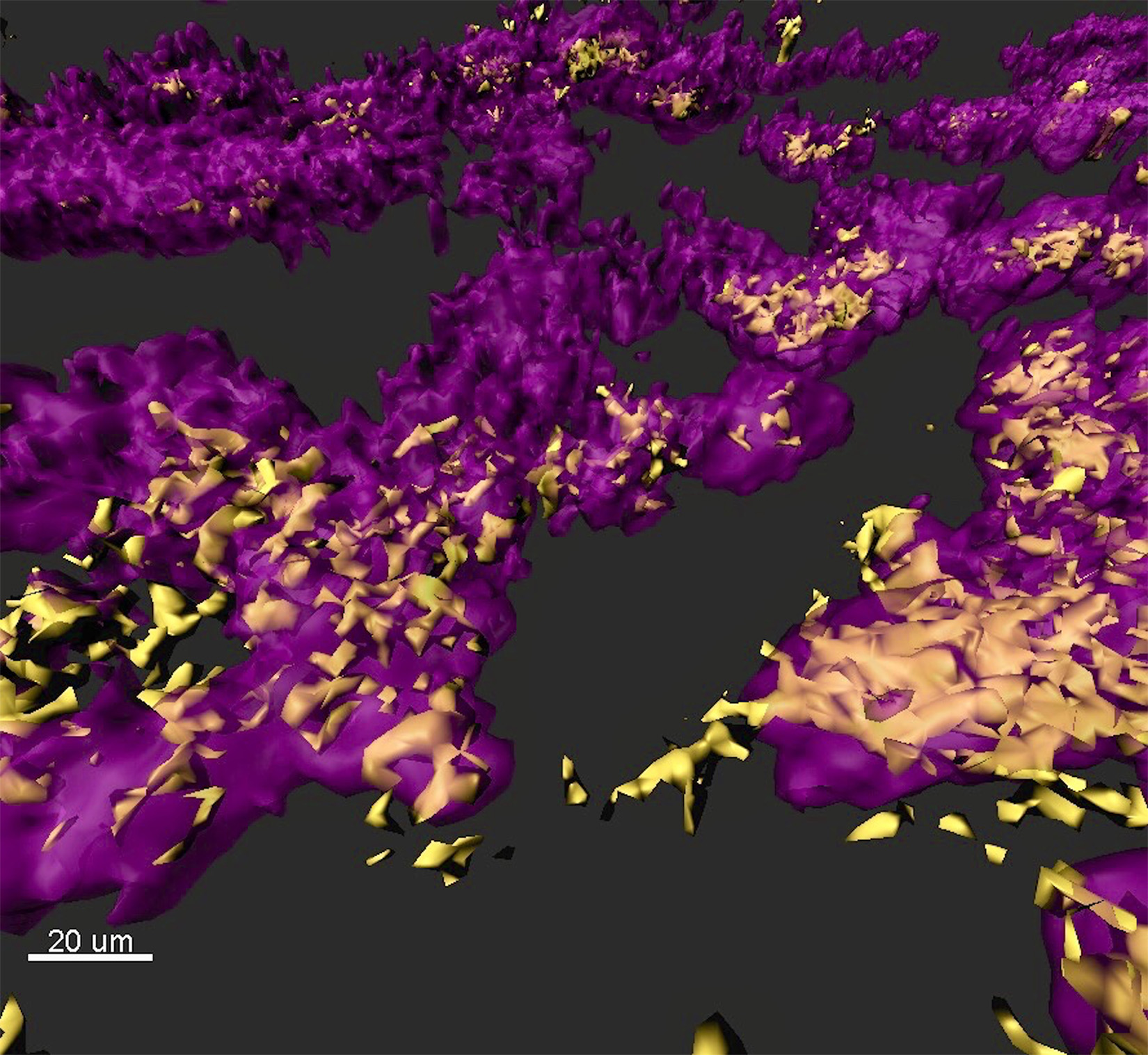 Bacterial biofilm