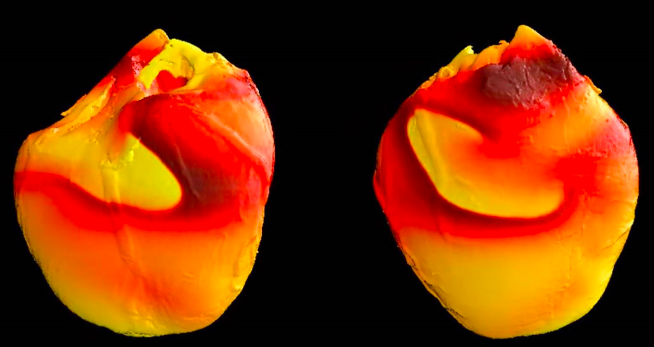 Cardiac spiral waves in a rabbit's heart (Photo FDA)