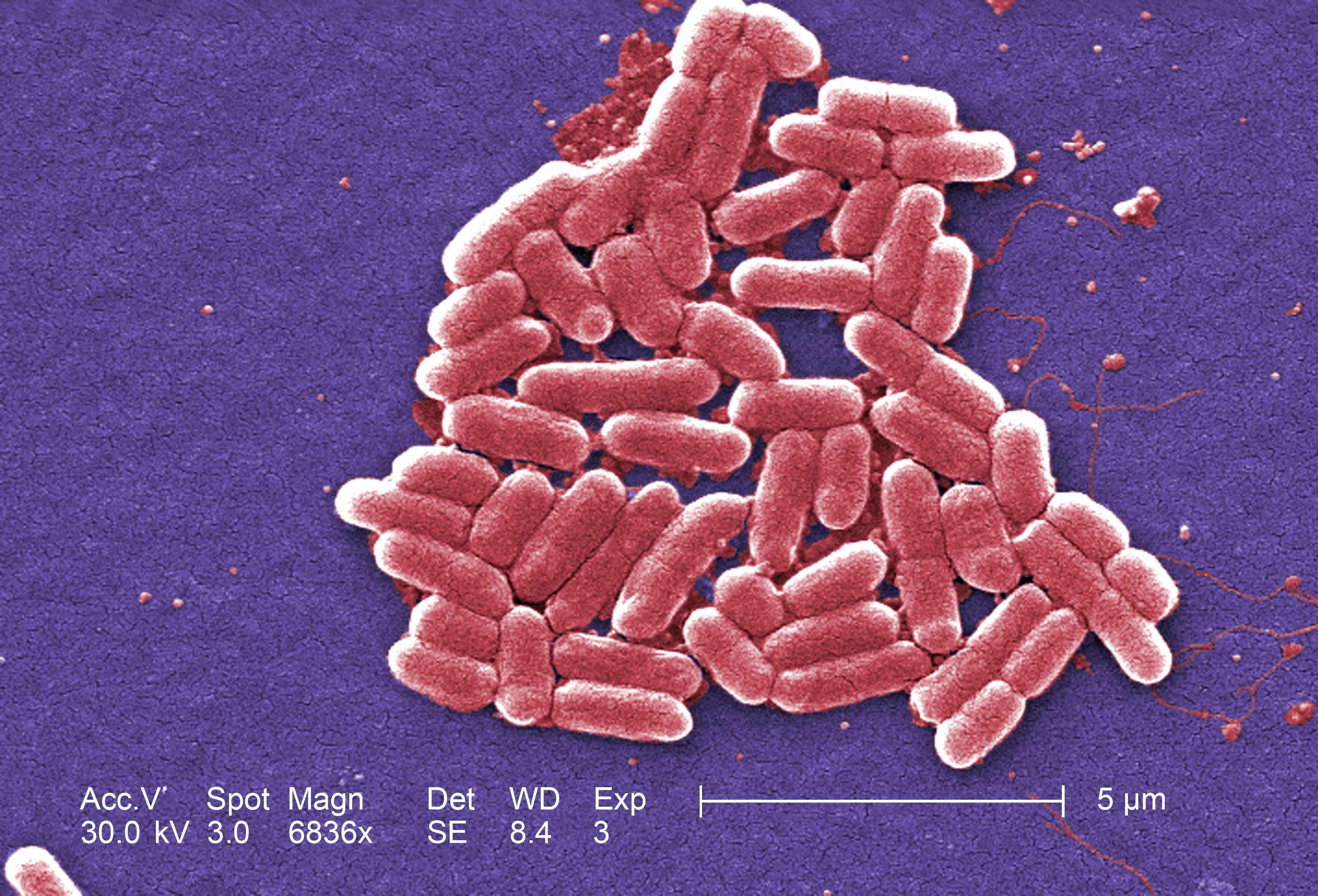 E. coli bacteria