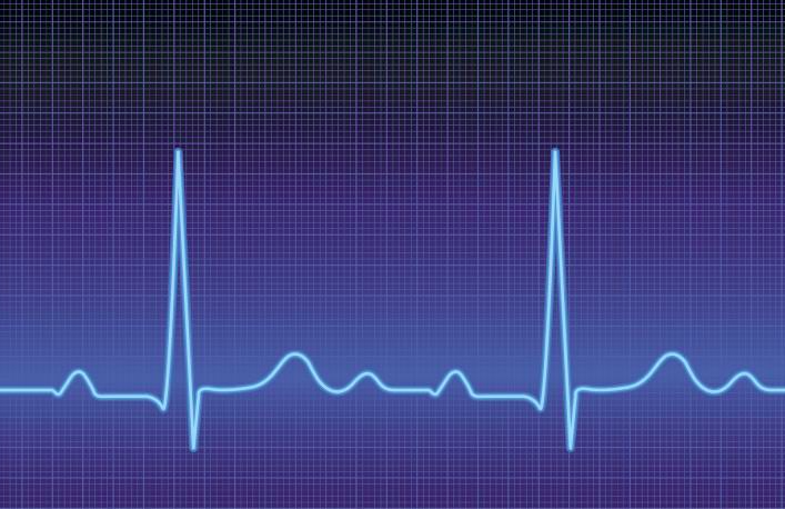 Electrocardiogram (Photo iStock)