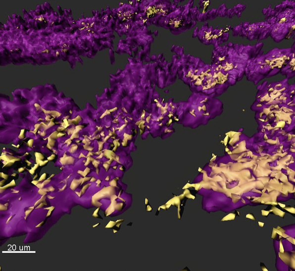 Bacterial biofilms 