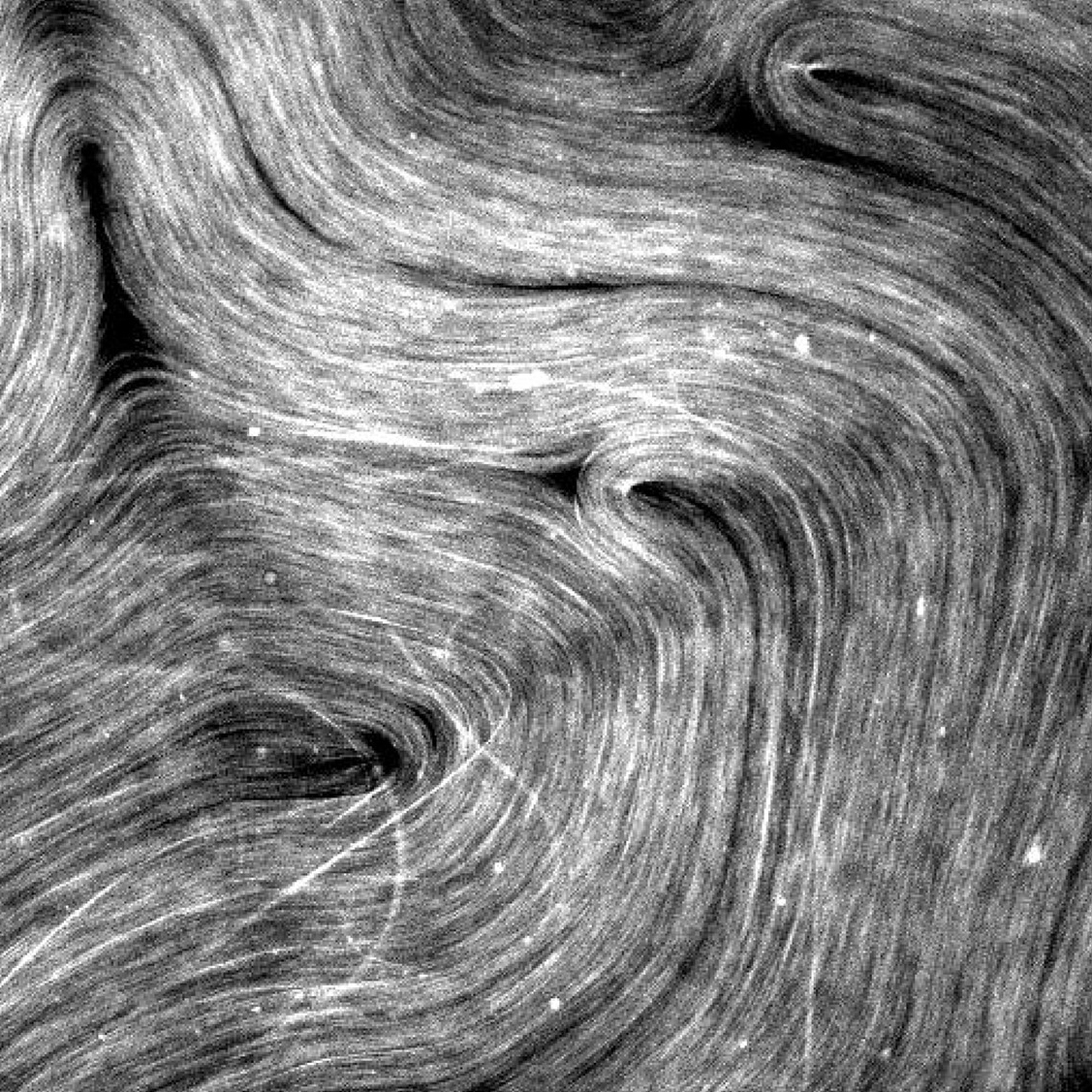 Three noticeable out-of-plane microtubule bundles are misaligned with the rest of the microtubules at the bottom left of the image.