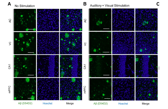 Before (left) and after images of reduced amyloid plaques in mice brains from a 2019 study. 