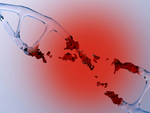 Double-strand breaks in DNA can be deadly Double-strand breaks in DNA can be deadly